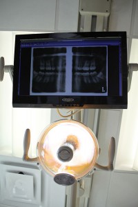 Our treatment room monitor setup allows the doctors to review x-rays and other information directly with the patient.