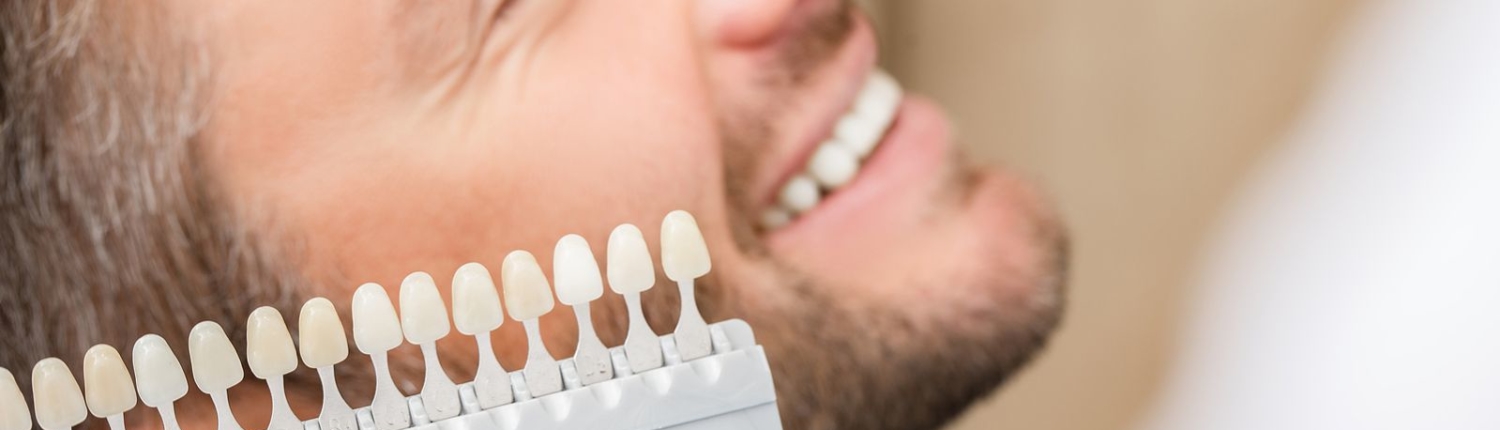 Dentist Uses A Palette Tooth crown